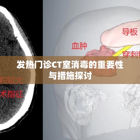 发热门诊CT室消毒的重要性与措施探讨