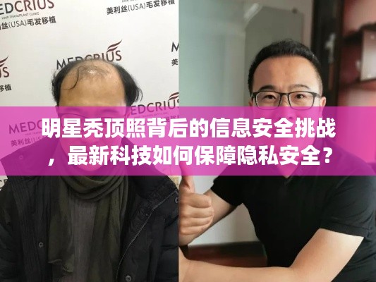 明星秃顶照背后的信息安全挑战，最新科技如何保障隐私安全？
