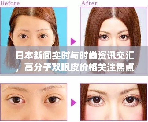日本新闻实时与时尚资讯交汇，高分子双眼皮价格关注焦点