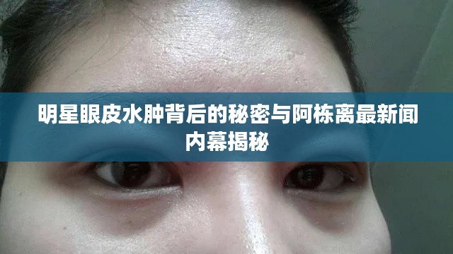 明星眼皮水肿背后的秘密与阿栋离最新闻内幕揭秘